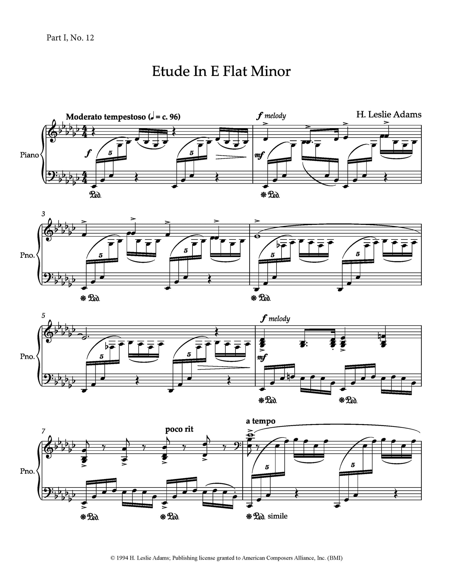 Etude in E-Flat Minor (Part I, No. 12)