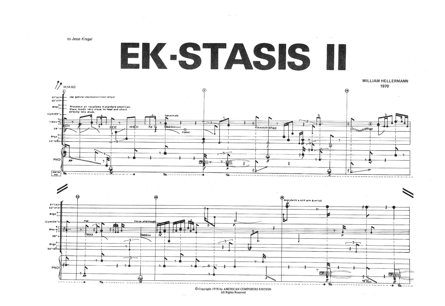 EK-STASIS II